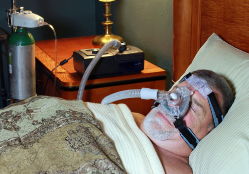 Sleep apnea
