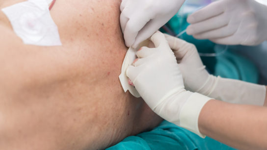 targeted epidural steroid injection