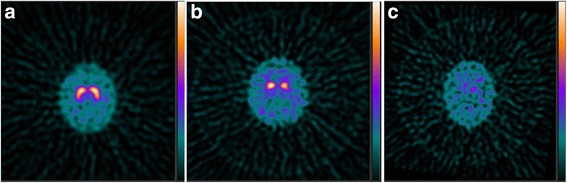 File:Fp-cit examples.jpg