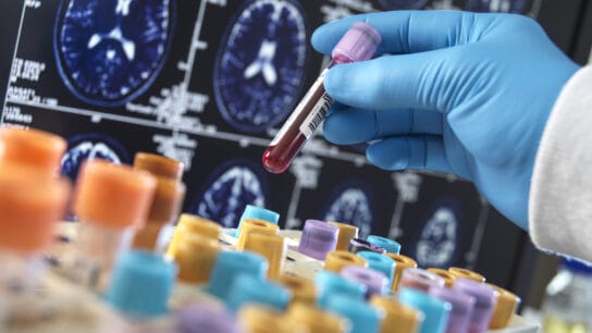 Scientist-working-with-samples-for-dementia-and-alzheimers-research