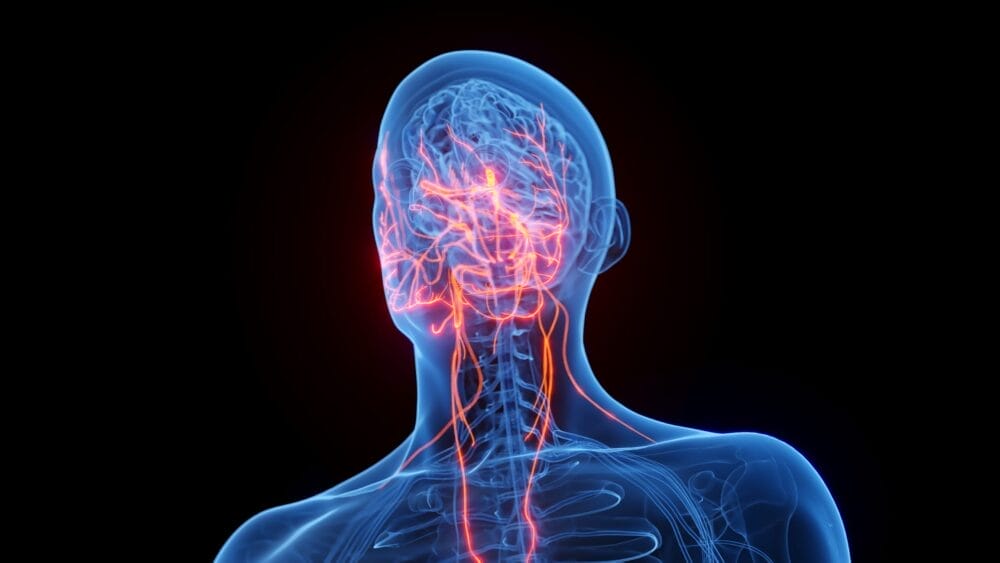 Vagus Nerve Stimulation for Rheumatoid Arthritis
