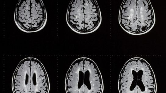 Diagnostic Challenges