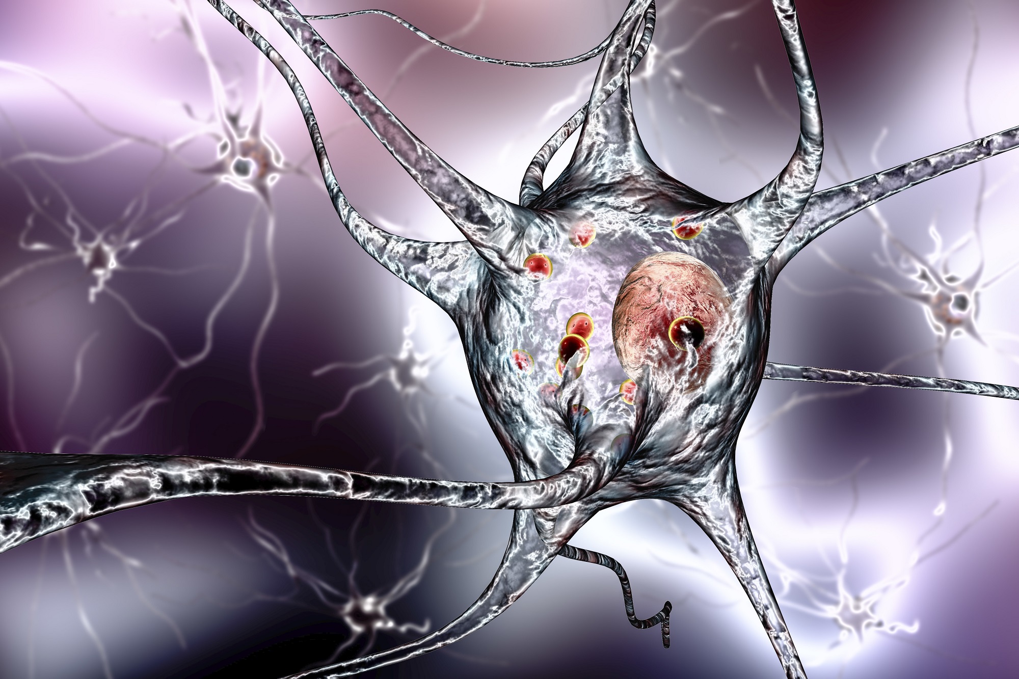 illustration of a Parkinson neuron