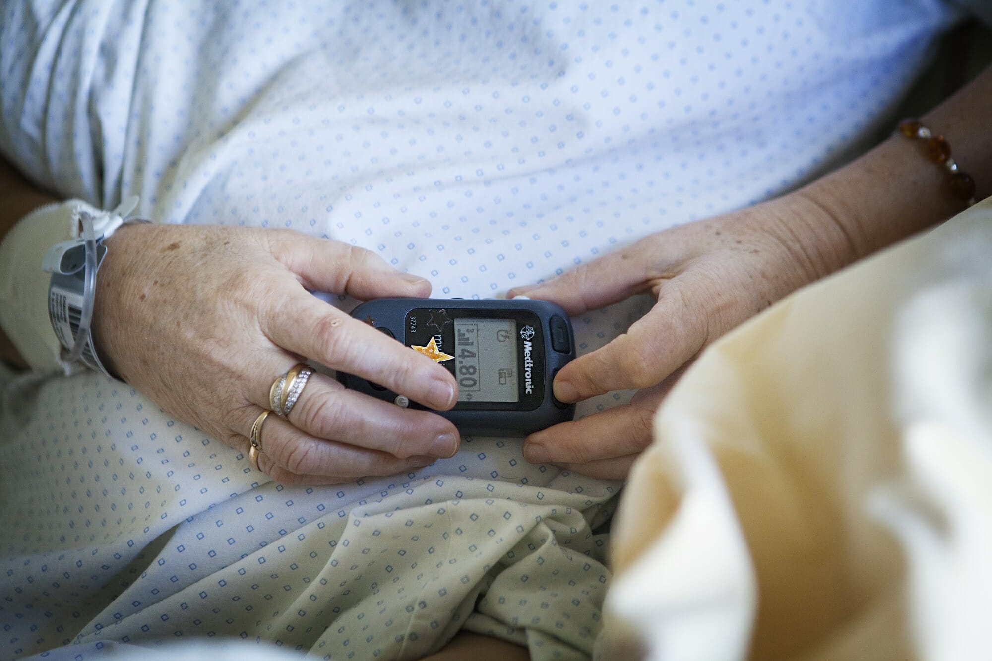 spinal cord stimulation