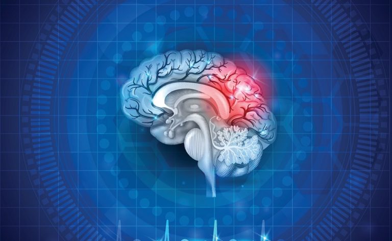 Image of damage to the brain