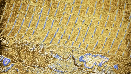 TEM of skeletal muscle