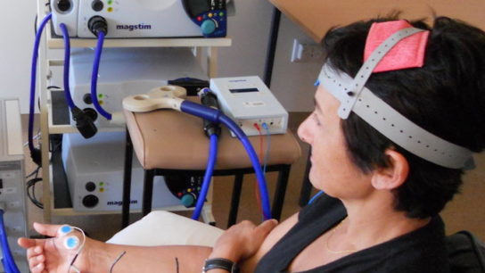 Transcranial Electrical Stimulation