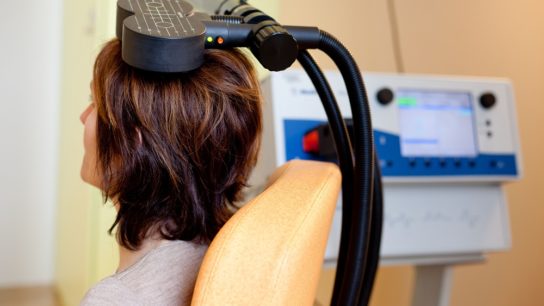 transcranial magnetic stimulation