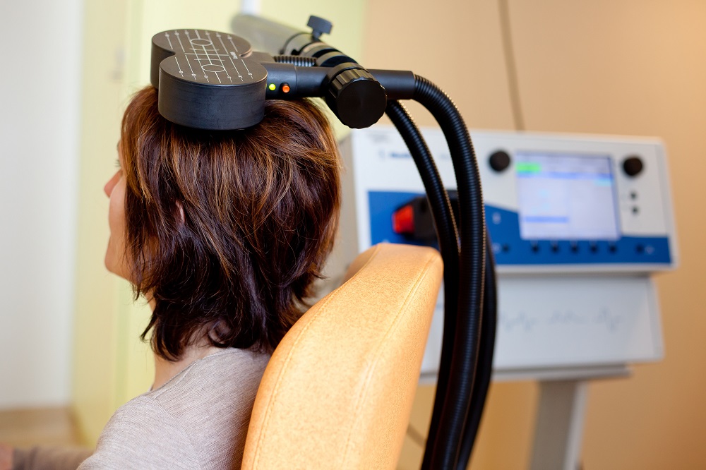 transcranial magnetic stimulation