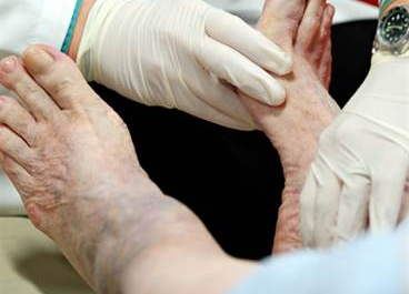 Sodium-Channels-Painful-Neuropathies